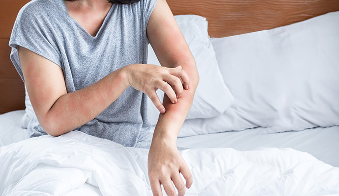 A person scratching a red allergic skin rash caused by indoor environmental triggers